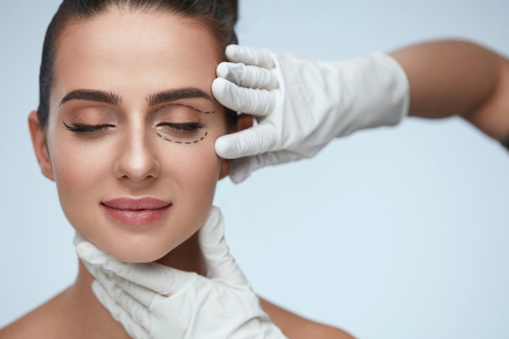 Clinician marking the upper eyelid before blepharoplasty surgery