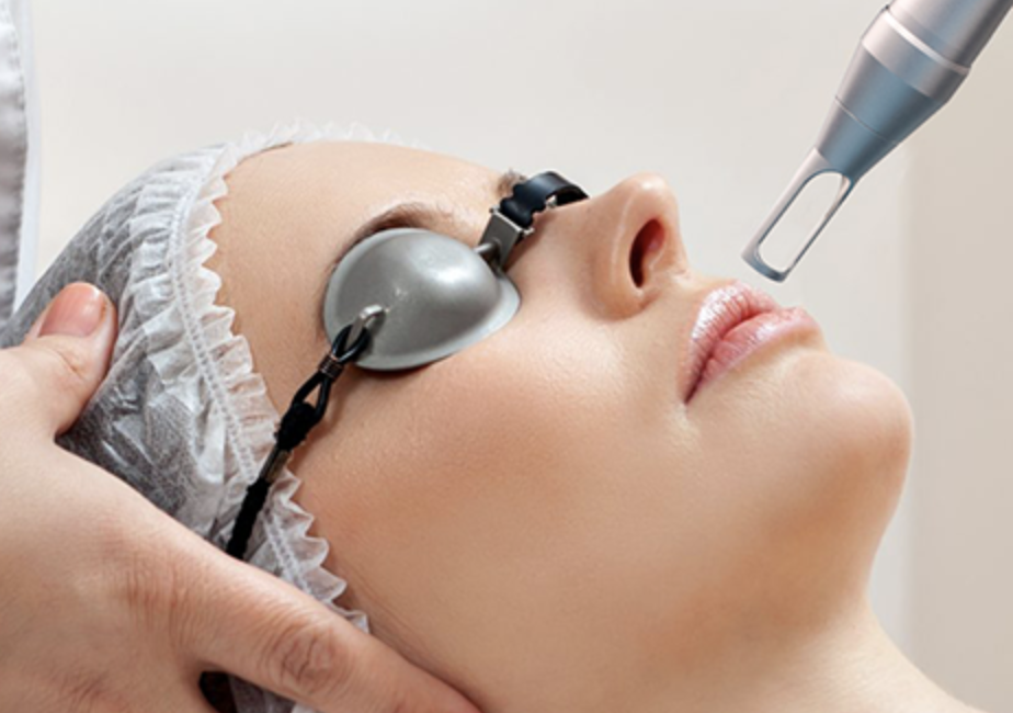 Pico laser skin treatment at Evolve Skin Clinic