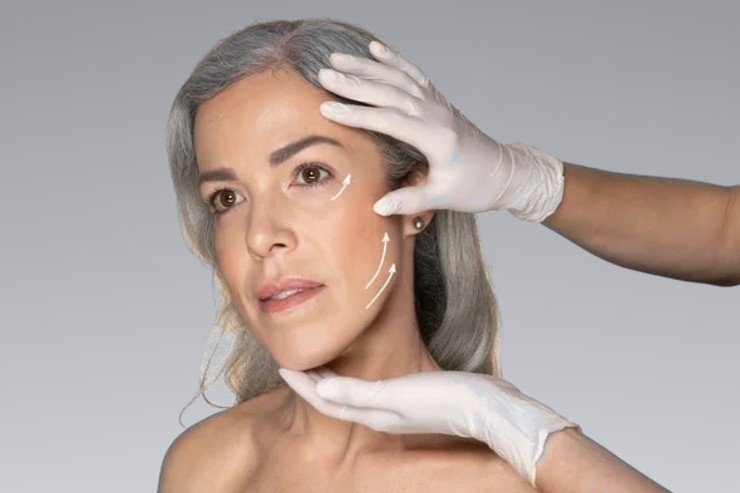 Facial Surgery